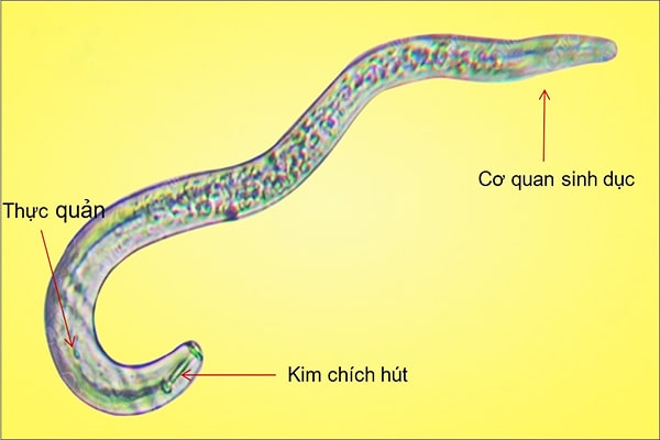 Tuyến trùng và 3 cách phòng trừ tuyến trùng bền vững
