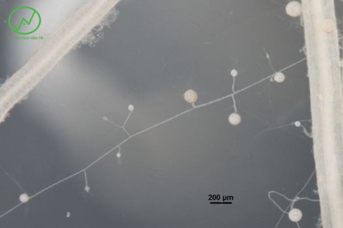 nam re cong sinh mycorrhizal 2